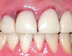 periodoncista-madrid